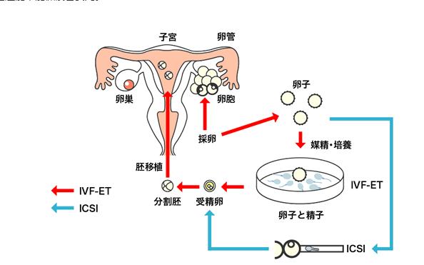 广州试管供卵儿子[广州试管供卵儿子的成长之路]